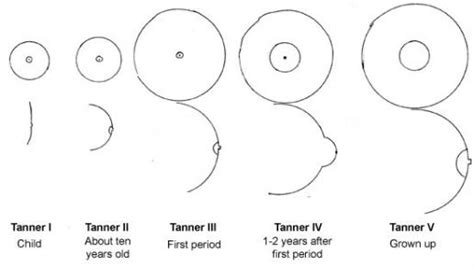 teen boob|Common Breast Conditions in Teens